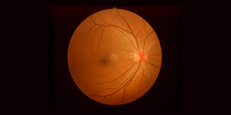 Retinal Vein