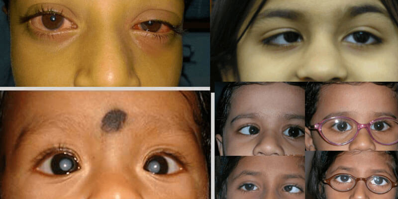 Paediatric Ophthalmologist