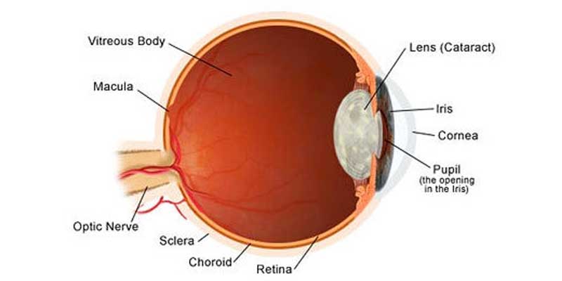 Combined Cataract