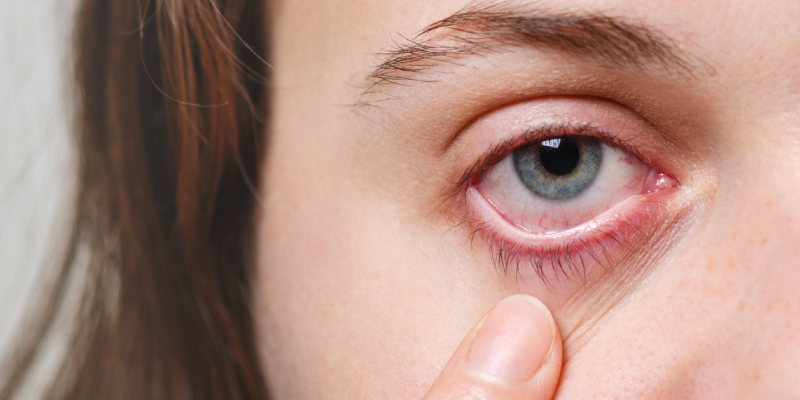 A woman is touching her eye with her finger.