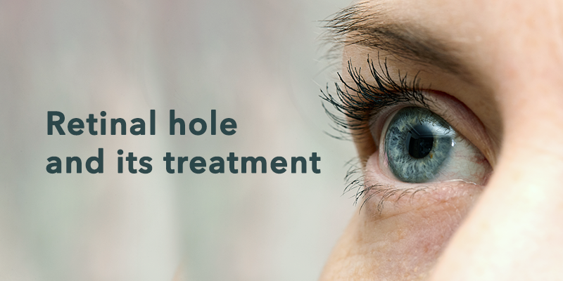 Retinal hole treatment.