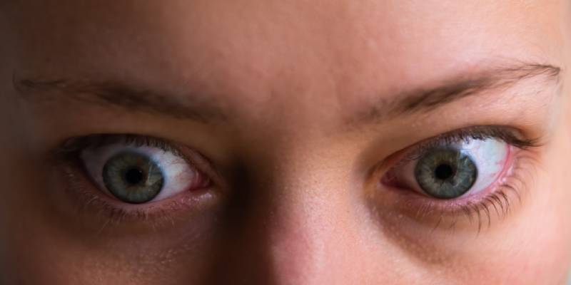 Is Thyroid Harming Your Eyes? Exploring Thyroid Eye Disease