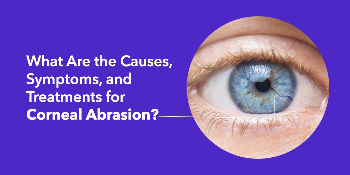 What Are the Causes, Symptoms, and Treatments for Corneal Abrasion?