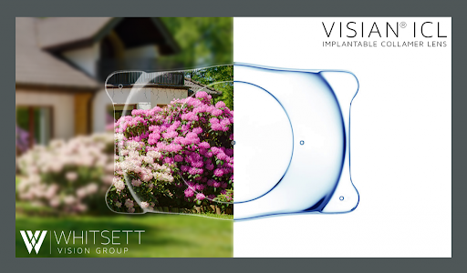 Lasik-and-refractive-surgery-3