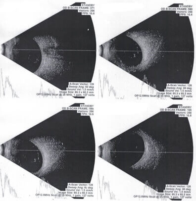 b-scan-report