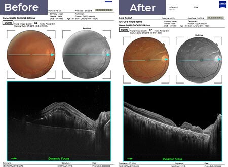 Neoretina Case Studies