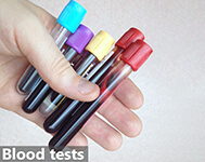 blood test