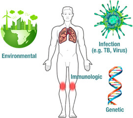 causes uveitis