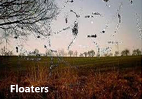 floaters