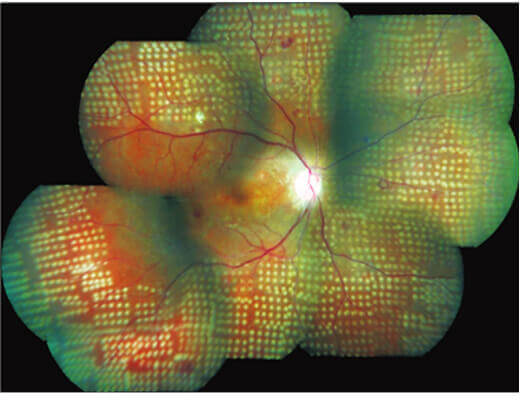 fundus