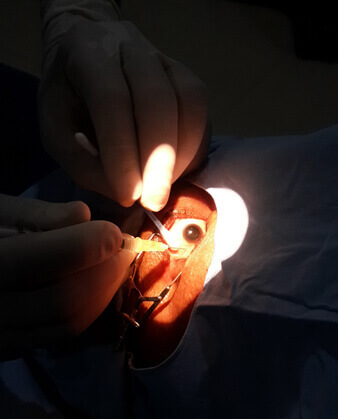 Intravitreal