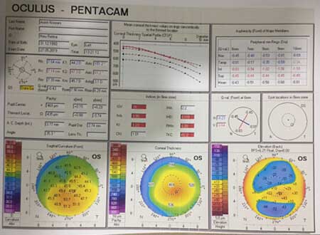 Neoretina Case Studies