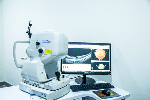OCT Angiography