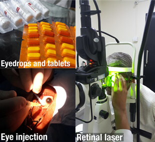 Treatment uveitis