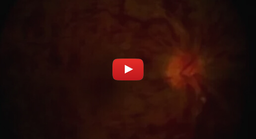 videothumb